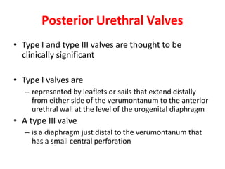 Posterior Urethral Valves
• Type I and type III valves are thought to be
clinically significant
• Type I valves are
– represented by leaflets or sails that extend distally
from either side of the verumontanum to the anterior
urethral wall at the level of the urogenital diaphragm
• A type III valve
– is a diaphragm just distal to the verumontanum that
has a small central perforation
 