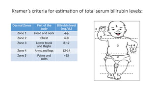 Kramer Test Neonatal Hyperbilirubinemia - Case Presentation | PPTX