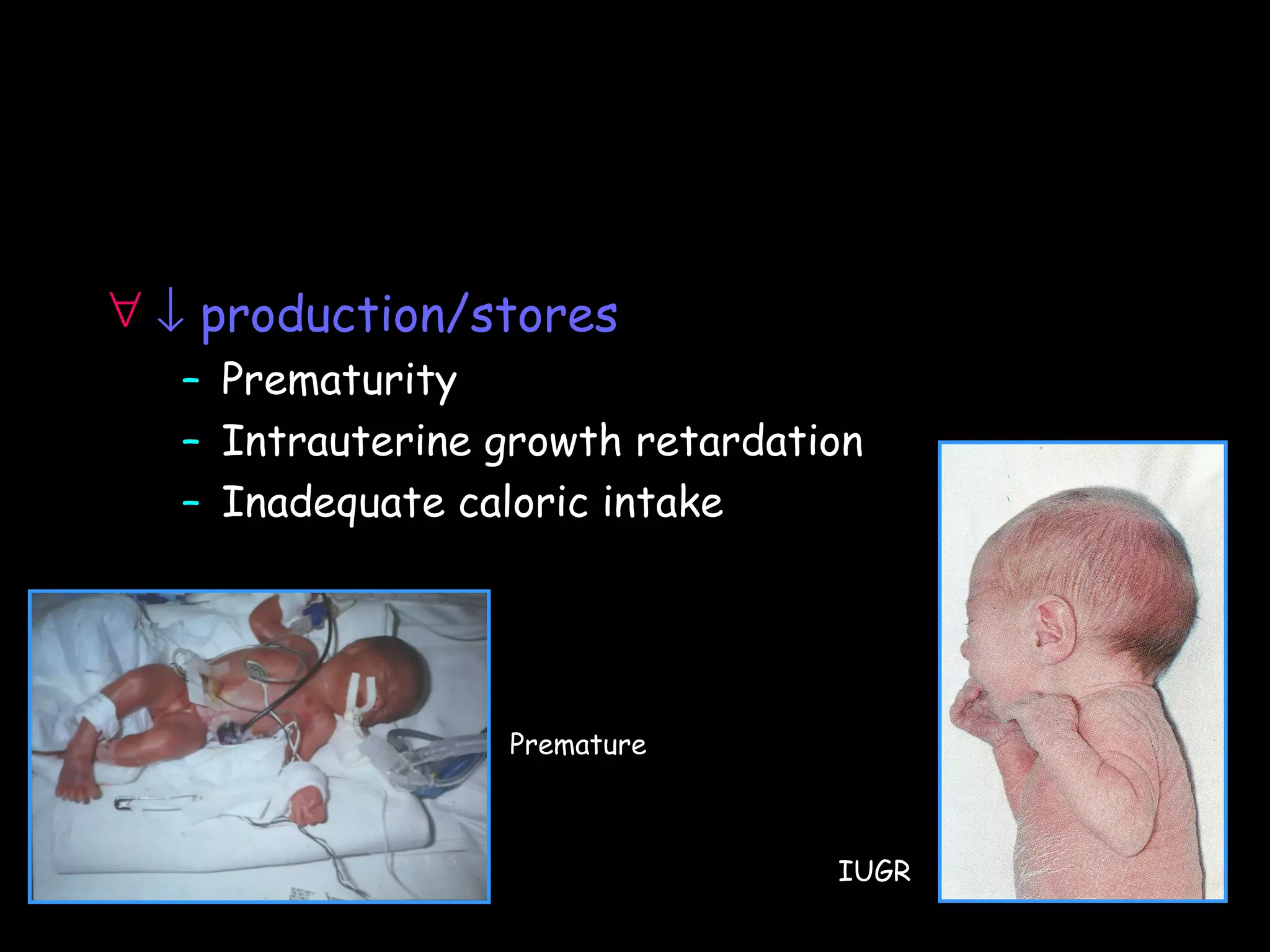 ∀ ↓ production/stores
   – Prematurity
   – Intrauterine growth retardation
   – Inadequate caloric intake




                  Premature



                                  IUGR
 