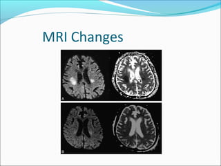 MRI Changes
 