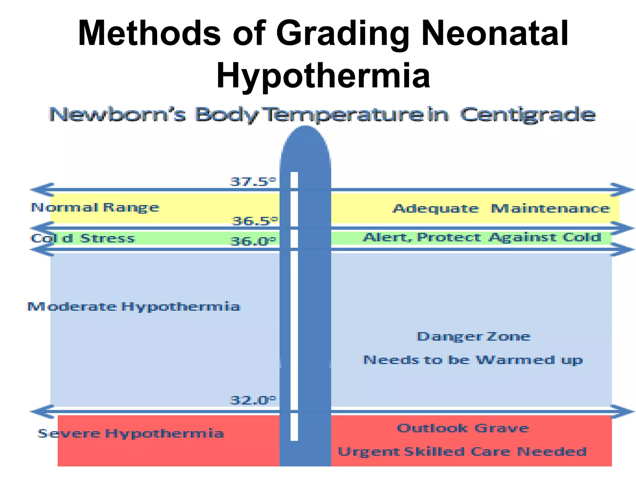 Neonatal hypothermia | PPTX