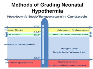Methods of Grading Neonatal
Hypothermia
 