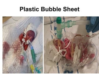 Plastic Bubble Sheet
 