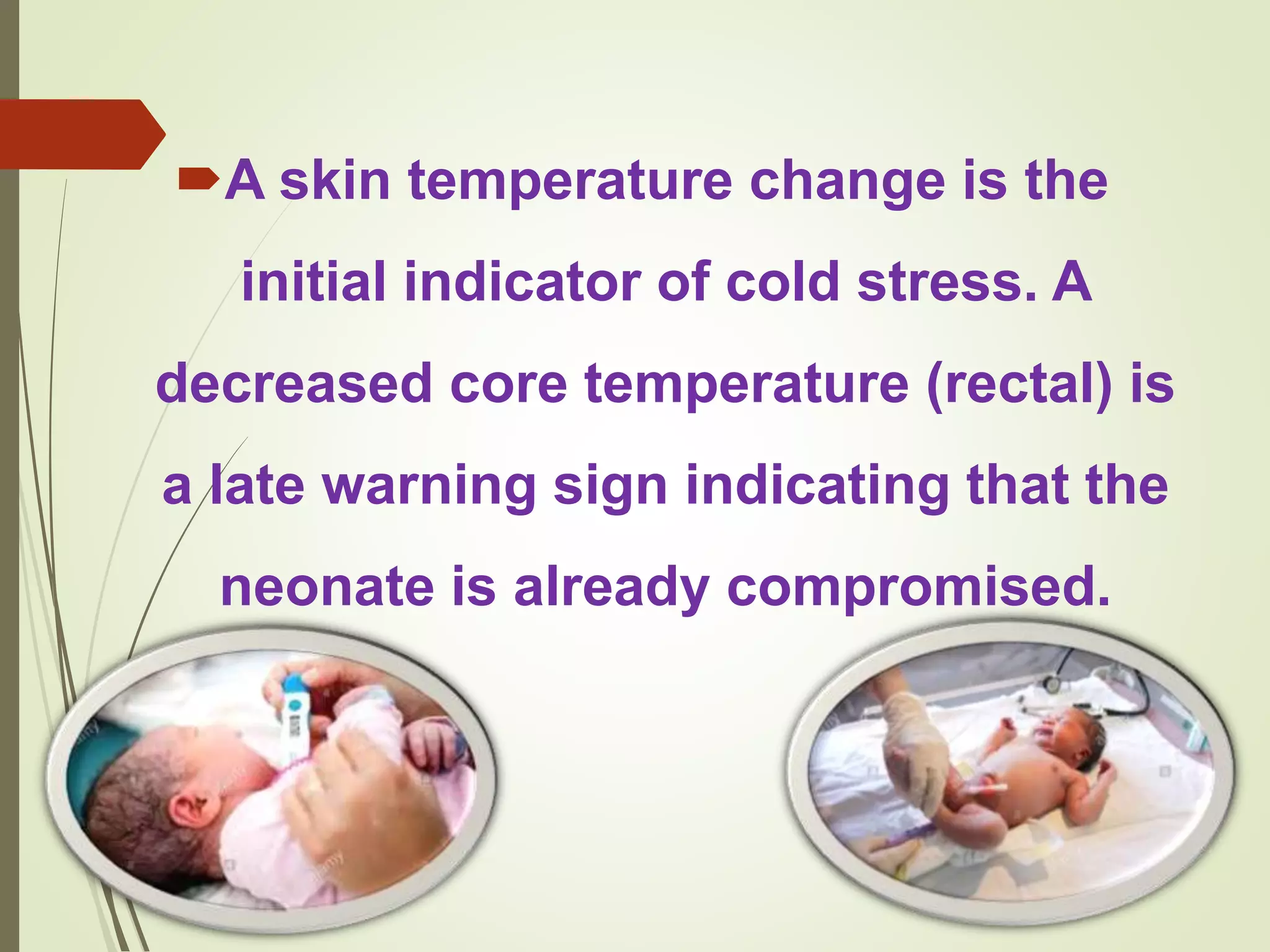 Neonatal hypothermia | PPTX