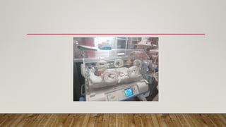 Neonatal hypothermia, the situation in low-resourced countries