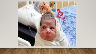 Neonatal hypothermia, the situation in low-resourced countries