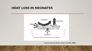 HEAT LOSS IN NEONATES
Source: Science Direct (Cinar and Filiz, 2006)
 