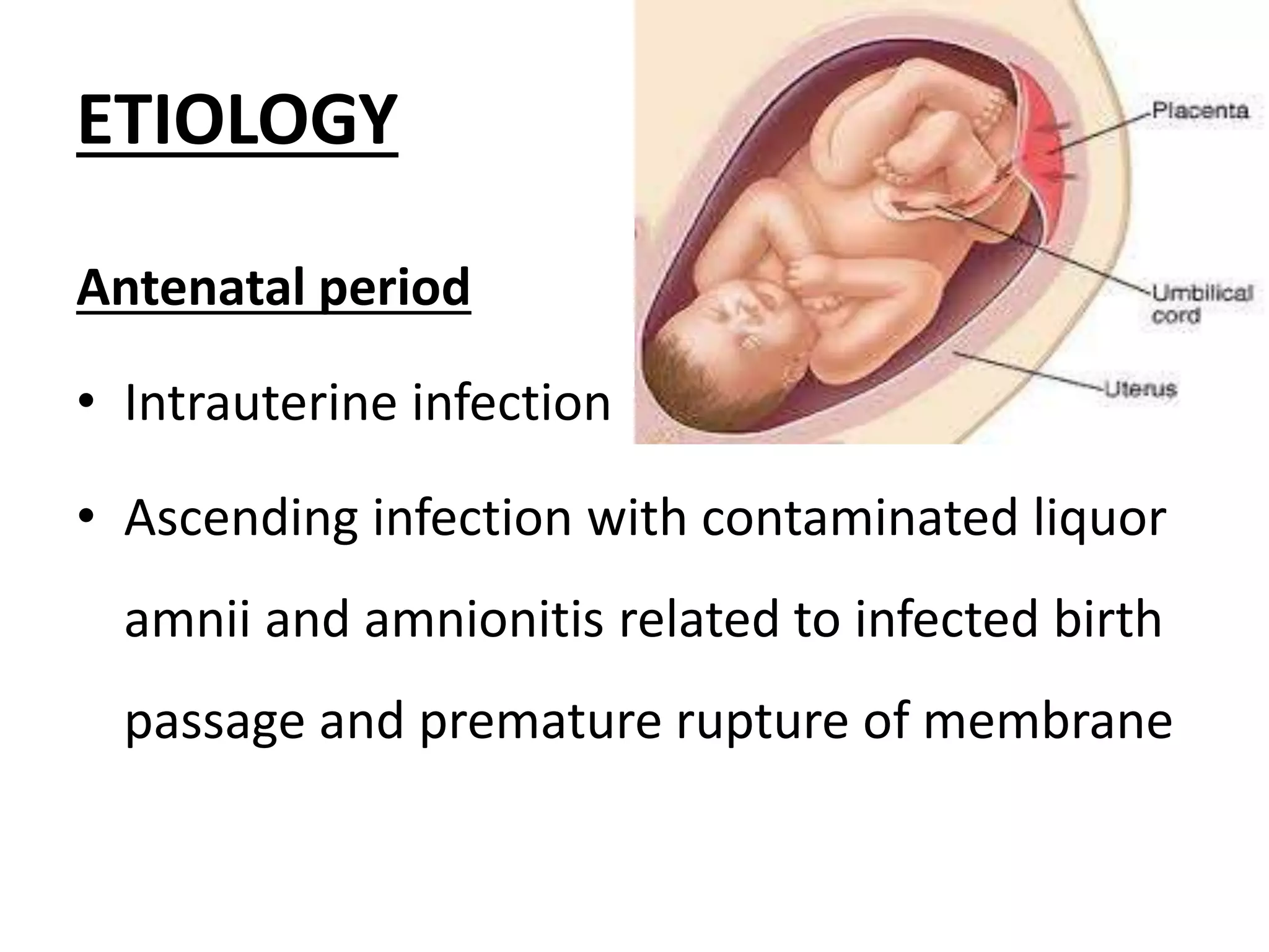 Neonatal Infection Types Neonatal infections | PPTX