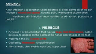 Pustule Newborn Rash neonatal infections/infections in newborn.pptx