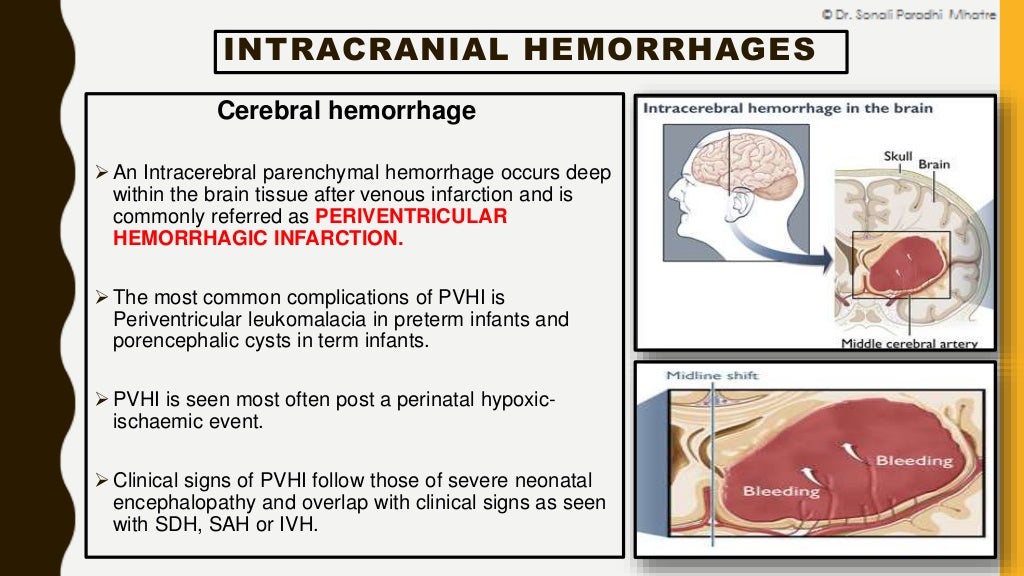 neonatal hemorrhage presentation
