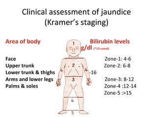 Kramer Test NEONATAL JAUNDICE 8/12/2015(HOWRAH) | PPT