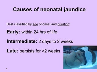 Best classified by age of onset and duration:
Early: within 24 hrs of life
Intermediate: 2 days to 2 weeks
Late: persists for >2 weeks
Causes of neonatal jaundice
 
