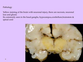 Pathalogy
Yellow staining of the brain with neuronal injury, there are necrosis, neuronal
loss and gliosis
Its commonly seen in the basal ganglia, hypocampus,cerebellum,brainstem &
spinal cord
 