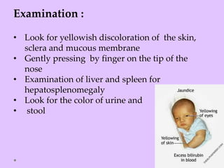 Examination :
• Look for yellowish discoloration of the skin,
sclera and mucous membrane
• Gently pressing by finger on the tip of the
nose
• Examination of liver and spleen for
hepatosplenomegaly
• Look for the color of urine and
• stool
 