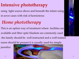 Intensive phototherapy
using light source above and beneath the infant using
in sever cases with risk of kernicterus
Home phototherapy
This is an option way of treatment where facilities are
available and fiber optic blankets are commonly used
.the family should be well instructed and a well trained
nurse should be present it is usually used for simple
jaundice
 