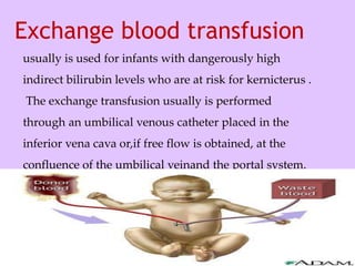 Exchange blood transfusion
usually is used for infants with dangerously high
indirect bilirubin levels who are at risk for kernicterus .
The exchange transfusion usually is performed
through an umbilical venous catheter placed in the
inferior vena cava or,if free flow is obtained, at the
confluence of the umbilical veinand the portal system.
 