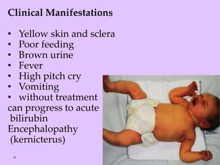 Clinical Manifestations
• Yellow skin and sclera
• Poor feeding
• Brown urine
• Fever
• High pitch cry
• Vomiting
• without treatment
can progress to acute
bilirubin
Encephalopathy
(kernicterus)
 