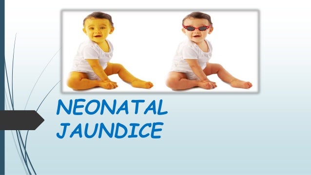 Case study on neonatal jaundice slideshare image