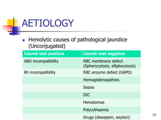 AETIOLOGY
 Hemolytic causes of pathological jaundice
(Unconjugated)
12
Coomb test positive Coomb test negative
ABO incompatibility RBC membrane defect
(Spherocytosis, elliptocytosis)
Rh incompatibility RBC enzyme defect (G6PD)
Hemoglobinopathies
Sepsis
DIC
Hematomas
Polycythaemia
Drugs (diazepam, oxytoci)
 