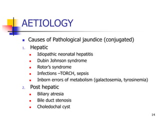 AETIOLOGY
 Causes of Pathological jaundice (conjugated)
1. Hepatic
 Idiopathic neonatal hepatitis
 Dubin Johnson syndrome
 Rotor’s syndrome
 Infections –TORCH, sepsis
 Inborn errors of metabolism (galactosemia, tyrosinemia)
2. Post hepatic
 Biliary atresia
 Bile duct stenosis
 Choledochal cyst
14
 