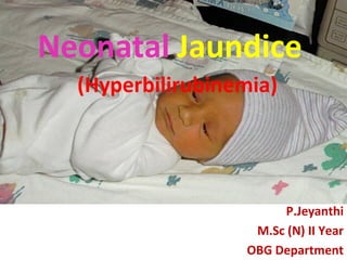 JaundiceNeonatal
(Hyperbilirubinemia)
P.Jeyanthi
M.Sc (N) II Year
OBG Department
 