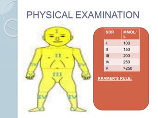Kramer Test Physiological jaundice among newborns/ Icterus neonatorum | PPTX