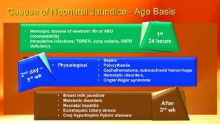 • Hemolytic disease of newborn: Rh or ABO
incompatibility
• Intrauterine infections: TORCH, cong malaria, G6PD
deficiency
• Sepsis
• Polycythemia
• Cephalhematoma, subarachnoid hemorrhage
• Hemolytic disorders,
• Crigler-Najjar syndrome
• Breast milk jaundicie
• Metabolic disorders
• Neonatal hepatitis
• Extrahepatic biliary atresia
• Conj Hyperttophic Pyloric stenosis
• Physiological
1st
24 hours
After
3rd wk
 