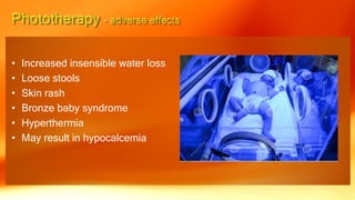 • Increased insensible water loss
• Loose stools
• Skin rash
• Bronze baby syndrome
• Hyperthermia
• May result in hypocalcemia
 