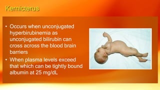 • Occurs when unconjugated
hyperbirubinemia as
unconjugated bilirubin can
cross across the blood brain
barriers
• When plasma levels exceed
that which can be tightly bound
albumin at 25 mg/dL
 