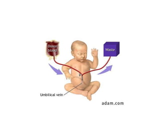 neonatal jaundice.pdf