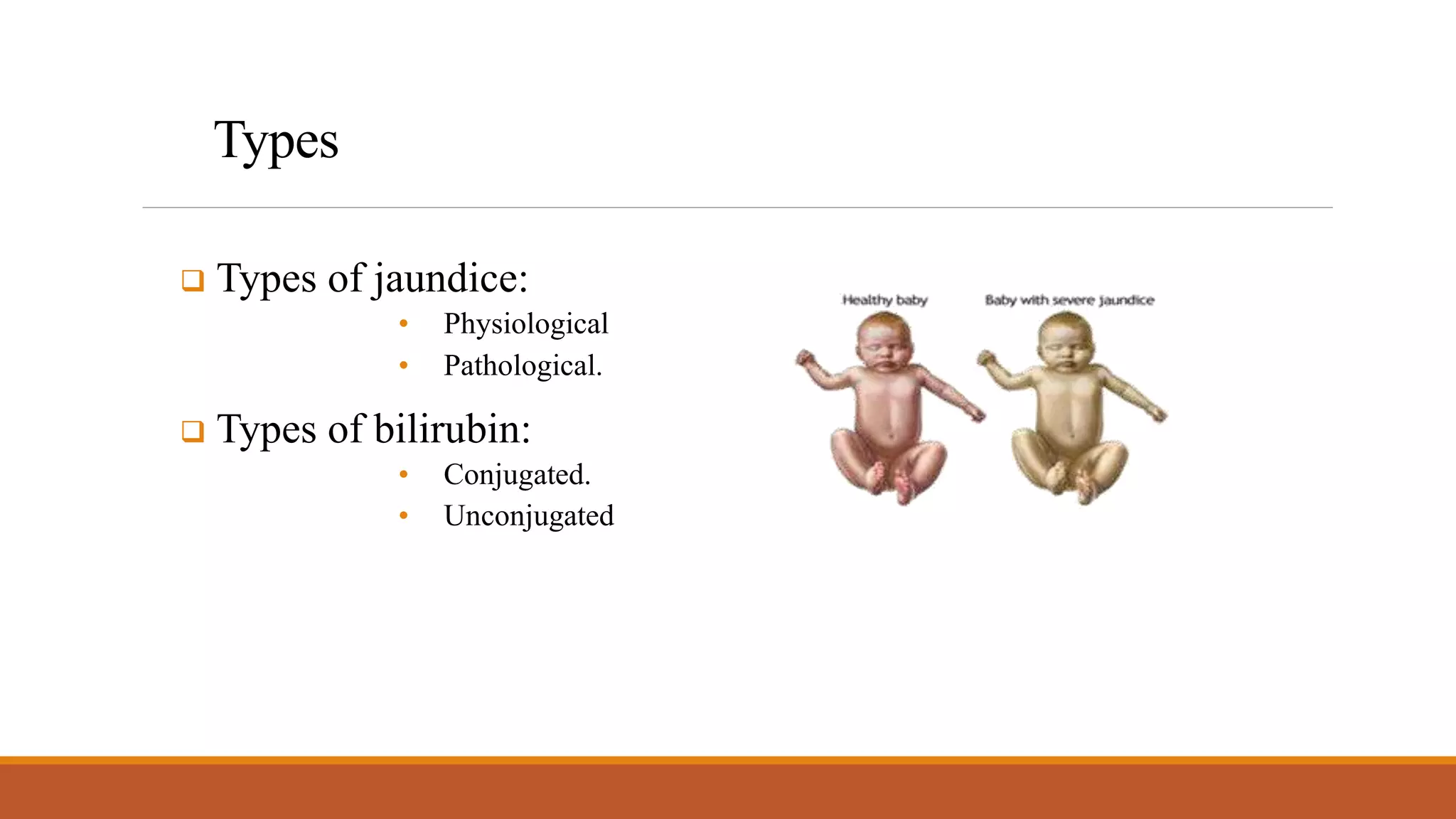 Pathologic Jaundice Neonatal Jaundice.pptx