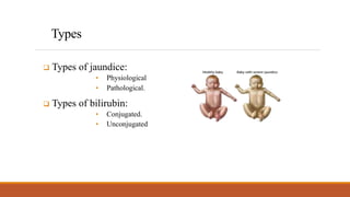 Neonatal Jaundice.pptx
