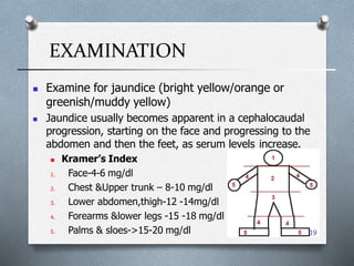 EXAMINATION
19
 Examine for jaundice (bright yellow/orange or
greenish/muddy yellow)
 Jaundice usually becomes apparent in a cephalocaudal
progression, starting on the face and progressing to the
abdomen and then the feet, as serum levels increase.
 Kramer’s Index
1. Face-4-6 mg/dl
2. Chest &Upper trunk – 8-10 mg/dl
3. Lower abdomen,thigh-12 -14mg/dl
4. Forearms &lower legs -15 -18 mg/dl
5. Palms & sloes->15-20 mg/dl
 