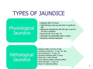 TYPES OF JAUNDICE
• Appears after 24 hours
• Total bilirubin rises by less than 5 mg/dl per
day
• Maximum intensity by 4th-5th day in term &
7th day in preterm
• Serum level 12-15 mg / dl
• Clinically not detectable after 14 days
• Resolves without treatment
Physiological
Jaundice
• Appears within 24 hours of age
• Increase of bilirubin > 5 mg / dl / day
• Serum bilirubin > 15 mg / dl
• Jaundice persisting after 14 days
• Stool clay / white colored
• Urine staining yellow, staining clothes
• Direct bilirubin > 2 mg / dl
• Signs of underlying illness
Pathological
Jaundice
7
 