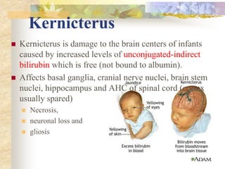 Kernicterus Features Neonatal jaundice.pptx