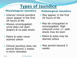 Pathologic Jaundice Neonatal Jaundice I Yarqan (Unani Concept).pptx
