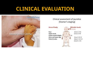 CLINICAL EVALUATION
 