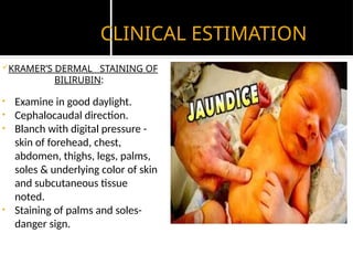 CLINICAL ESTIMATION
KRAMER’S DERMAL STAINING OF
BILIRUBIN:
• Examine in good daylight.
• Cephalocaudal direction.
• Blanch with digital pressure -
skin of forehead, chest,
abdomen, thighs, legs, palms,
soles & underlying color of skin
and subcutaneous tissue
noted.
• Staining of palms and soles-
danger sign.
 