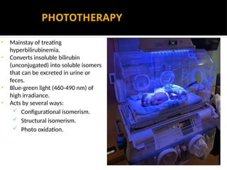 PHOTOTHERAPY
• Mainstay of treating
hyperbilirubinemia.
• Converts insoluble bilirubin
(unconjugated) into soluble isomers
that can be excreted in urine or
feces.
• Blue-green light (460-490 nm) of
high irradiance.
• Acts by several ways:
 Configurational isomerism.
 Structural isomerism.
 Photo oxidation.
 