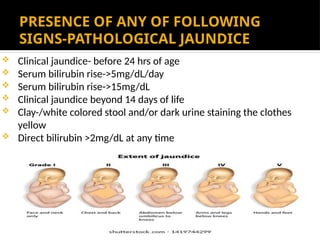 PRESENCE OF ANY OF FOLLOWING
SIGNS-PATHOLOGICAL JAUNDICE
 Clinical jaundice- before 24 hrs of age
 Serum bilirubin rise->5mg/dL/day
 Serum bilirubin rise->15mg/dL
 Clinical jaundice beyond 14 days of life
 Clay-/white colored stool and/or dark urine staining the clothes
yellow
 Direct bilirubin >2mg/dL at any time
 