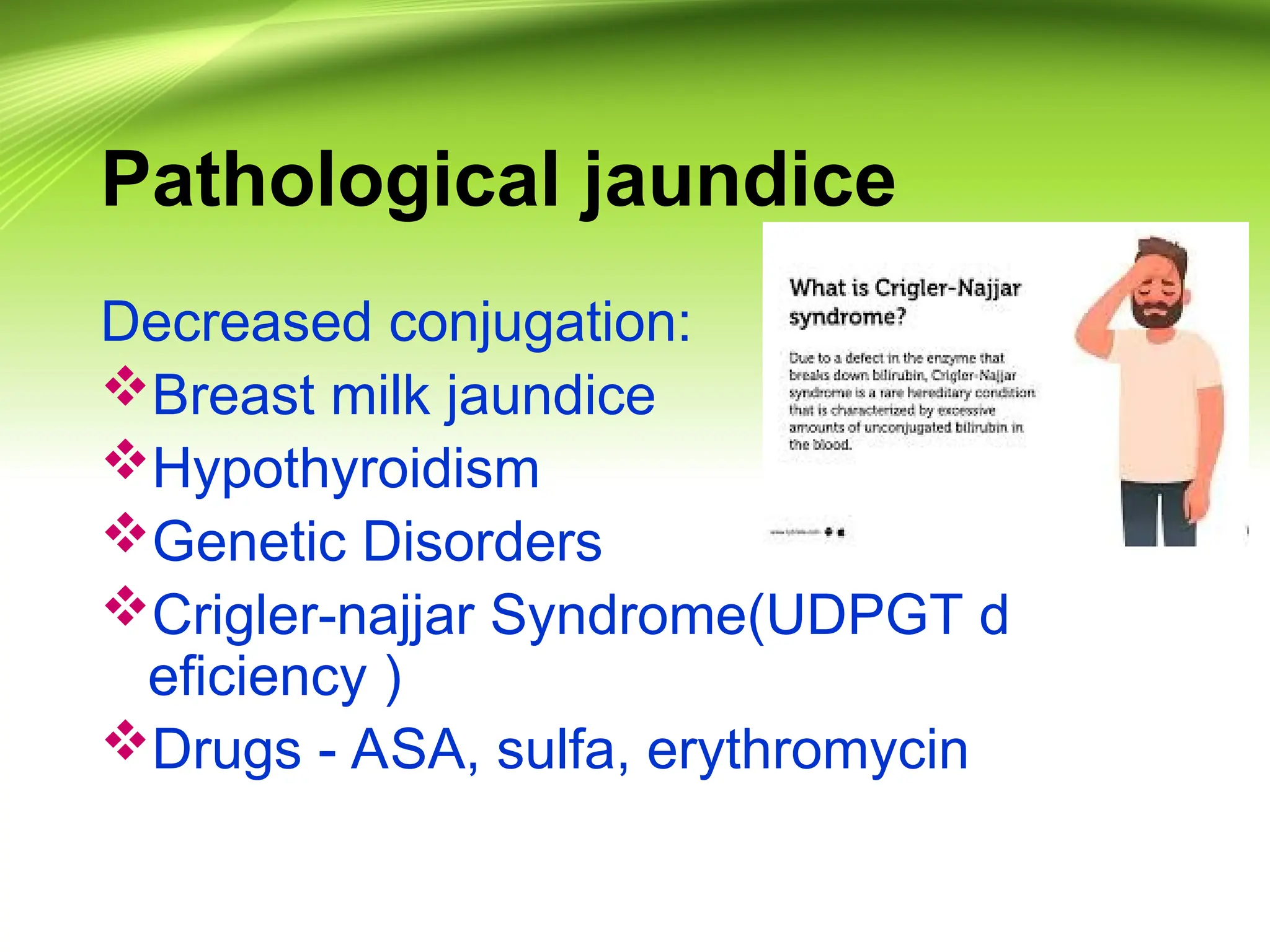 Pathological jaundice
Decreased conjugation:
Breast milk jaundice
Hypothyroidism
Genetic Disorders
Crigler-najjar Syndrome(UDPGT d
eficiency )
Drugs - ASA, sulfa, erythromycin
 