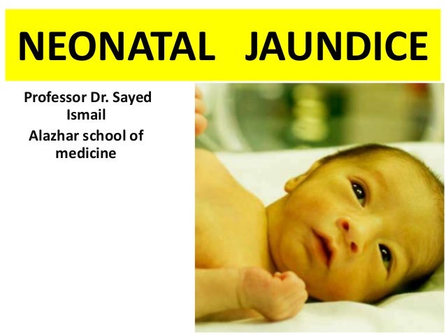 Aap Chart For Neonatal Jaundice