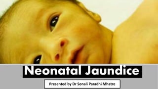 Neonatal Jaundice
Presented by Dr Sonali Paradhi Mhatre
 