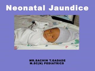 Neonatal Jaundice
MR.SACHIN T.GADADE
M.SC(N) PEDIATRICS
 