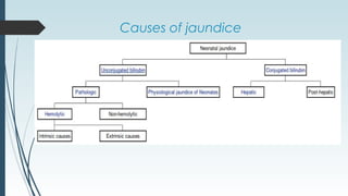 Causes of jaundice
 