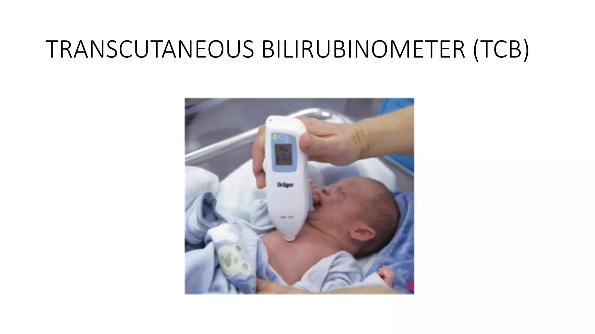 TRANSCUTANEOUS BILIRUBINOMETER (TCB)
 