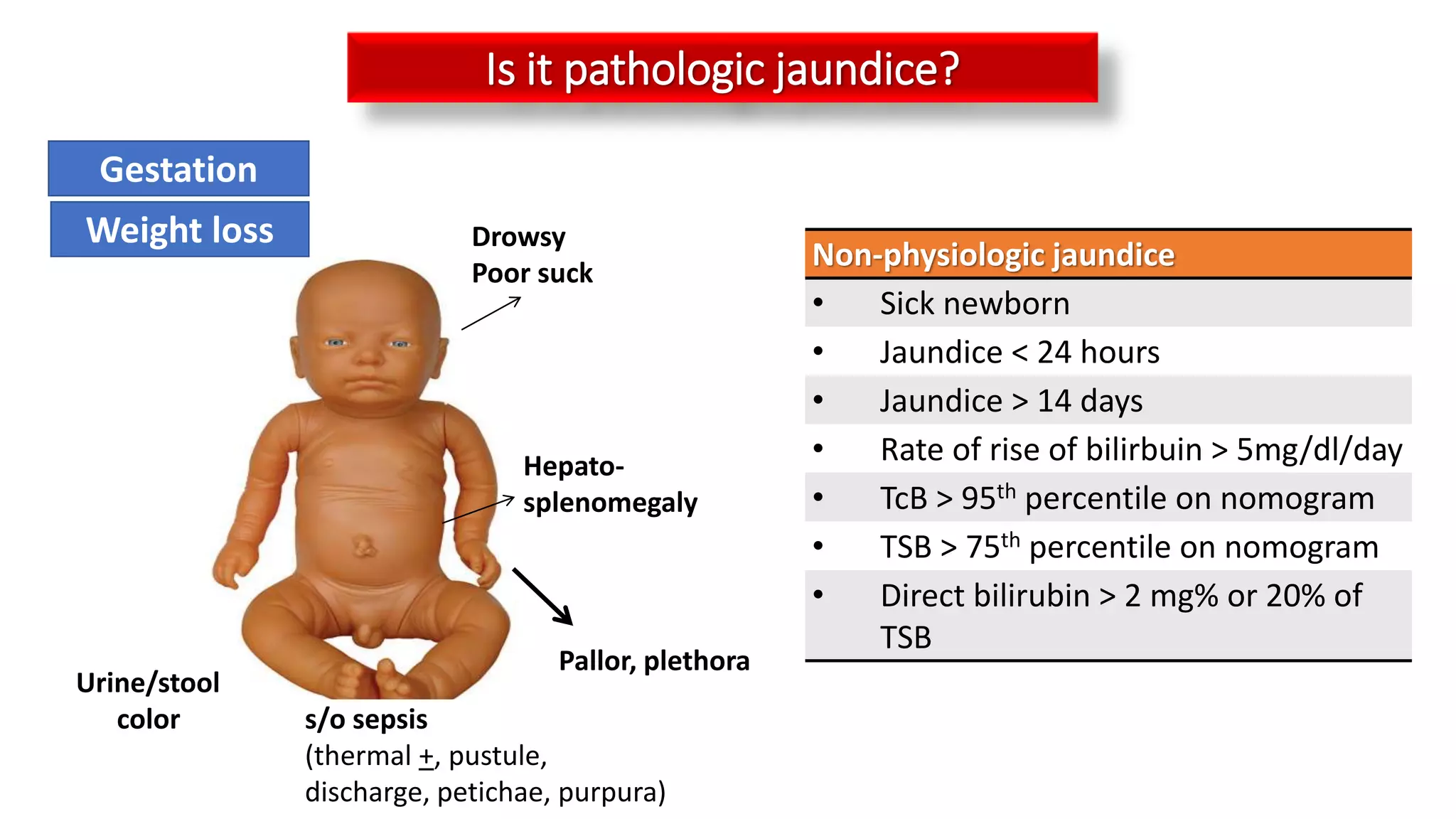Pallor, plethora
s/o sepsis
(thermal +, pustule,
discharge, petichae, purpura)
Hepato-
splenomegaly
Drowsy
Poor suck
Is it pathologic jaundice?
Urine/stool
color
Gestation
Weight loss
Non-physiologic jaundice
• Sick newborn
• Jaundice < 24 hours
• Jaundice > 14 days
• Rate of rise of bilirbuin > 5mg/dl/day
• TcB > 95th percentile on nomogram
• TSB > 75th percentile on nomogram
• Direct bilirubin > 2 mg% or 20% of
TSB
 