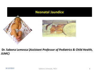 Neonatal Jaundice
8/12/2022 Sabona Lemessa, MD+ 1
Dr. Sabona Lemessa (Assistant Professor of Pediatrics & Child Health,
JUMC)
 