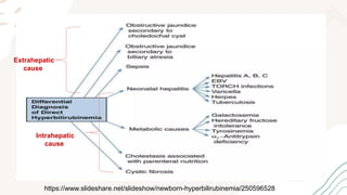 Jaundice Management Racgp Neonatal jaundice by Raghad FM R2 Latest AAP Guideline 2022 | PPTX