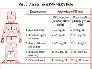 Kramer Test managment of neonataljaundice case 2.pptx